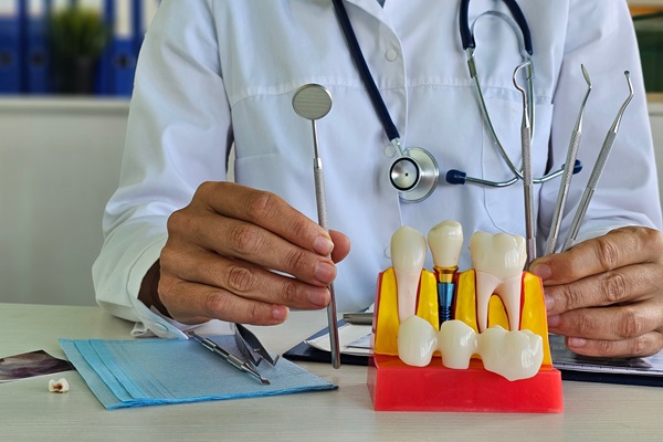 The Dental Crown Placement Process